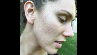 Why I Wash My Face With Dr Bronners Castile Soap Acne Prone Skin PH Acid Oil etc [upl. by Roxana]