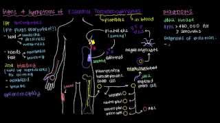 What is essential thrombocythemia [upl. by Kieryt]