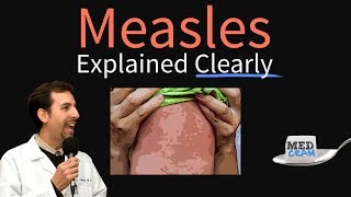 Measles rubeola Explained Clearly by MedCramcom [upl. by Eimmas]