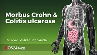 Morbus Crohn und Colitis ulcerosa  wirklich unbekannte Ursache  Dr med Schmiedel  QS24 [upl. by Doran]