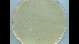 Preparation of Competent Cells Using Calcium Chloride  Amrita University [upl. by Sousa]