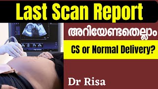 Pregnancy Last Scan Report Malayalam  9 Month Scan [upl. by Mali]