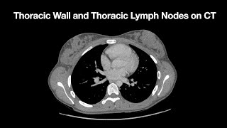 Anatomy of the Thoracic Wall and Thoracic Lymph Node Stations on CT [upl. by Horodko]