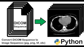 How to Convert a DICOM file into an Image jpg png tif etc using Python  Sequence DICOM Files [upl. by Sondra]