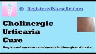 Cholinergic Urticaria Cure [upl. by Leonanie]