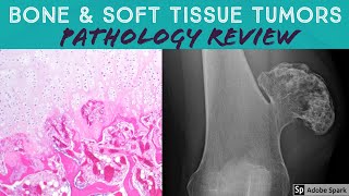 Bone amp Soft Tissue Pathology Board Review 21 Classic Cases [upl. by Tewfik]