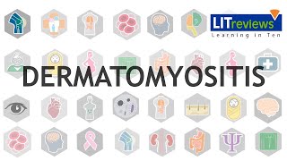 Dermatomyositis [upl. by Rabush501]