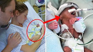 Preemie Baby Born in the Palm of a Mothers Hand Defies All Odds [upl. by Maida]