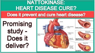 Nattokinase The Cure to Heart Disease [upl. by Brianne]