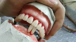 Enfilado dental inferior  prostodoncia  placa total [upl. by Nillad]