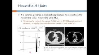 Medical Equipment Computed Tomography Arabic Narration [upl. by Stiruc]