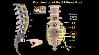 Examination Of S1 Nerve Root  Everything You Need To Know  Dr Nabil Ebraheim [upl. by Aiekam]