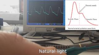 DIY Heart rate monitor with a photoresistor and 2 op amps [upl. by Nochur35]