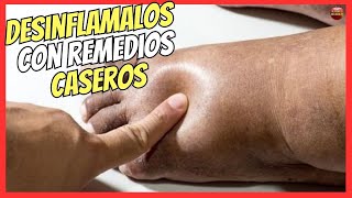 🔴 ¿COMO DESINFLAMAR LOS PIES HINCHADOS CON REMEDIOS CASEROS 🔥 [upl. by Narah418]