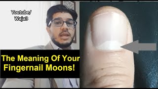 What They Tell About Your Health Personality Traits and Future Little Moons On Your Fingernails [upl. by Lam]