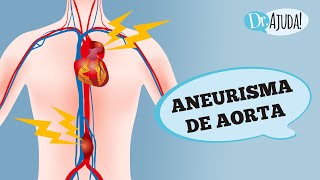 ANEURISMA DE AORTA O QUE É SINTOMAS E TRATAMENTO [upl. by Adnole]