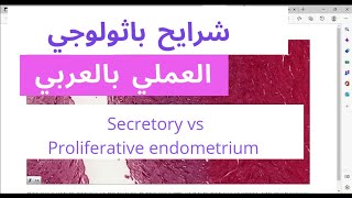 Secretory phase vs Proliferative phase endometrium  histology slide review [upl. by Sucramej]