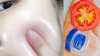 Apply vaseline and tomato on your skin and see the magic  Vaseline on face  Vasline beauty hacks [upl. by Oilisab]