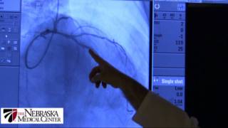 Coronary Stents  The Nebraska Medical Center [upl. by Sitnik]