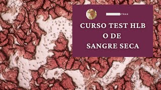 CURSO TEST HLB HLBO o de sangre seca [upl. by Acker]