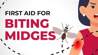 First Aid for Biting Midges [upl. by Aay113]