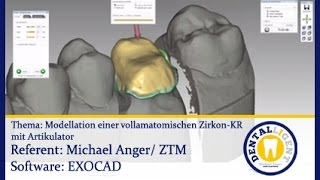 EXOCAD TUTORIAL Teaser  Modellation einer vollamatomischen ZirkonKR mit Artikulator [upl. by Purity]