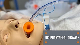 Oropharyngeal Airway Insertion [upl. by Lesoj]