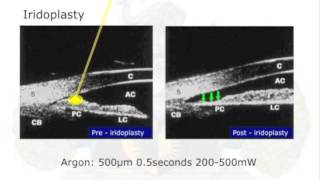 Plateau Iris Lecture by Gus Gazzard [upl. by Ttevi883]