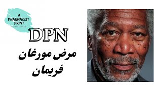 Dermatosis papulosa nigra DPN مرض الممثل مورغان فريمان تصبغات جلدية سوداء و بنية Morgan Freeman [upl. by Hafeetal15]