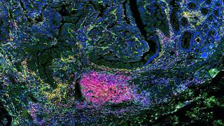 Introduction to Immunology [upl. by Etep]