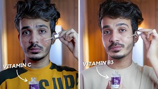 10 Pimple Mistakes  How to Remove Pimples From Face  Remove Acne Naturally [upl. by Akemet]