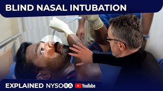 Blind Nasal SelfIntubation  Crash course with Dr Hadzic [upl. by Rosenwald871]