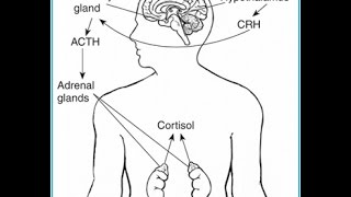 Cushing Syndrome [upl. by Eima]