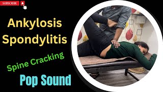 Dr Dentist Ankylosis Spondylosis Cracking Whole Body  ankylosing spondylitis patient [upl. by Glory]