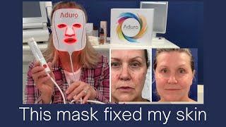 This mask FIXED my SKIN  ADURO LED Mask  BEST LIGHT THERAPY  Amazing RESULTS [upl. by Ikcir416]