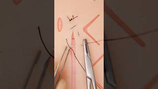 Mixed Sutures 😮 suturepractice surgery vet medicine surgeon stitches funfacts goodtoknow [upl. by Yennek]