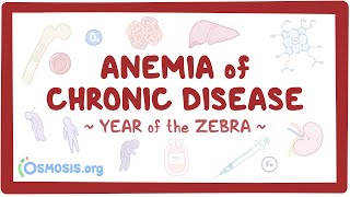 Anemia of chronic disease Year of the Zebra [upl. by Thisbe311]