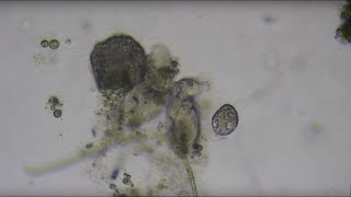 Paralyzing Ciliate  Suctoria [upl. by Alyel332]