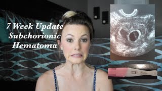 Surrogate Pregnancy 2 Subchorionic Hematoma 7 Weeks Pregnancy Update [upl. by Sidoma]