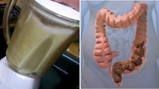 7 Poderosos Remedios Caseros Para El Colon Irritable [upl. by Pliske453]