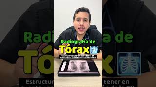 Radiografías de Tórax 🩻 shorts  GESCONS [upl. by Ryan]