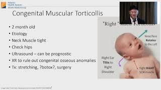 Torticollis [upl. by Padgett]