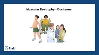 Muscular Dystrophy  Duchenne [upl. by Arac]