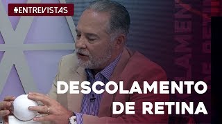 Tudo o que você precisa saber sobre o descolamento de retina [upl. by Reitman941]