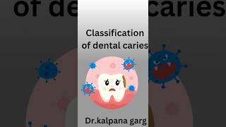 CLASSIFICATION OF DENTAL CARIES [upl. by Llacam637]