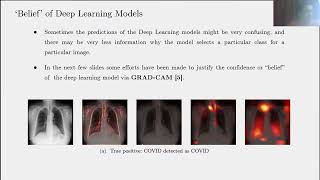 Classifying Chest XRay COVID19 images via Transfer Learning [upl. by Camden]