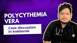 Hemoglobin bangmani blood o  Polycythemia Vera  blood cancer case discussion [upl. by Bing78]