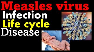 Measles virus  symptoms replication and treatment [upl. by Rici79]