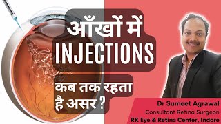 आँखों में INJECTION कब तक रहता है असर [upl. by Gris]