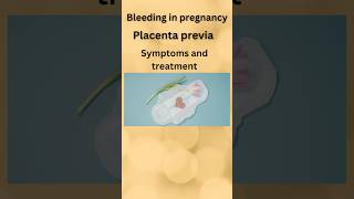 placenta previa low lying placenta bleeding in pregnancy shortspregnancy [upl. by Alra]